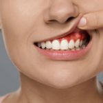 Gum Disease: The Silent Threat to Your Oral Health