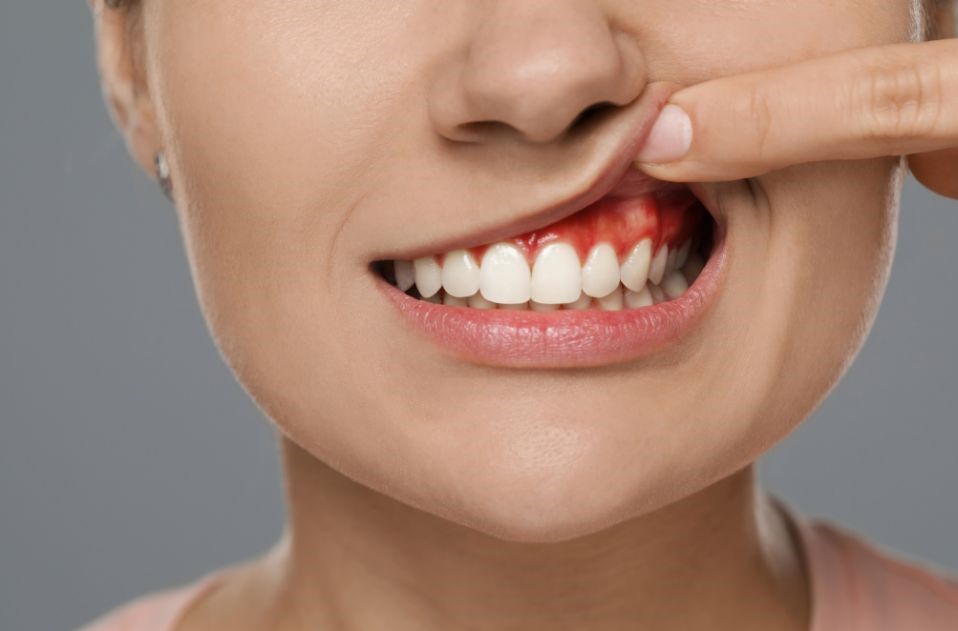 Gum Disease: The Silent Threat to Your Oral Health