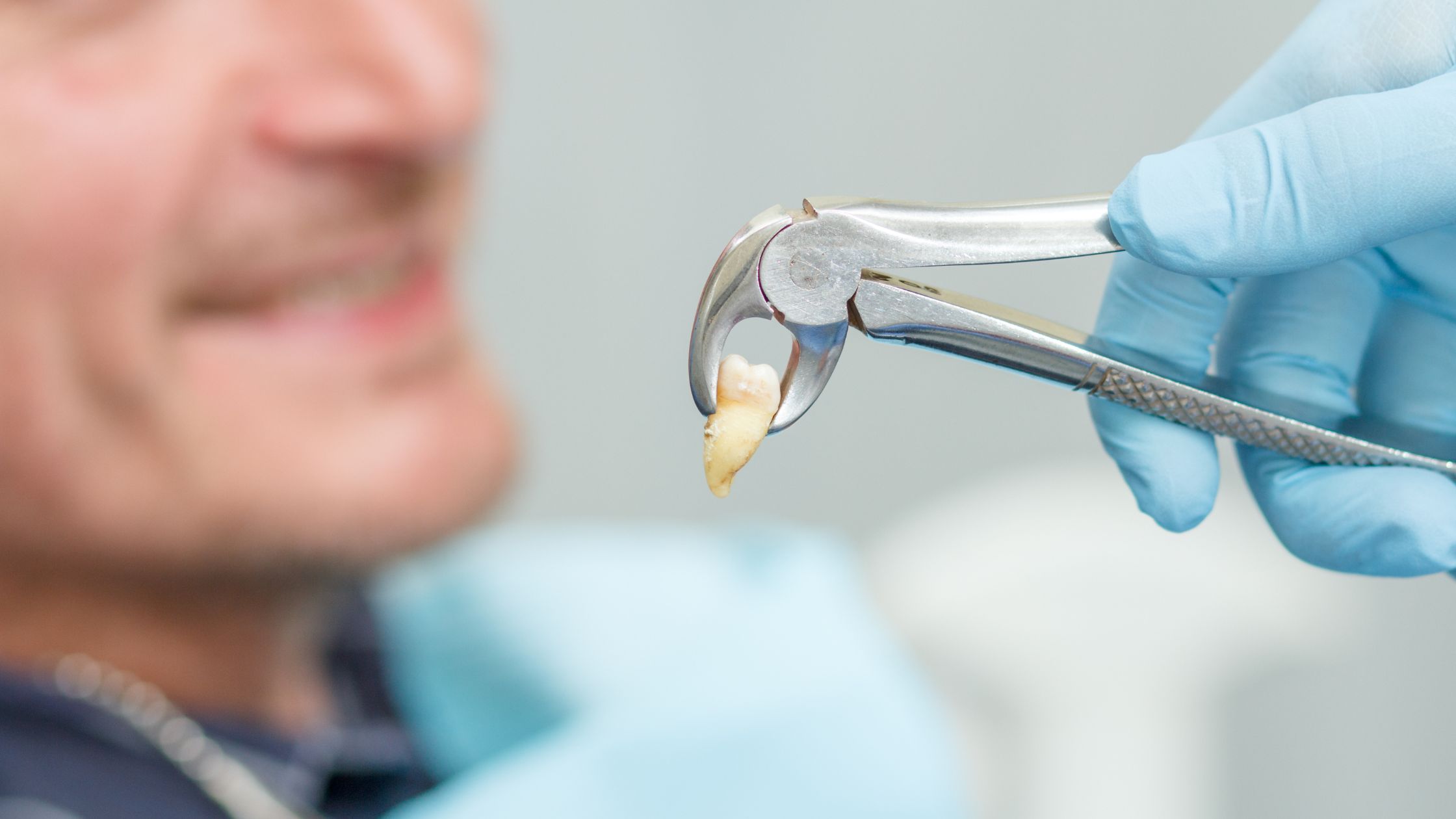 Wisdom Teeth Removal